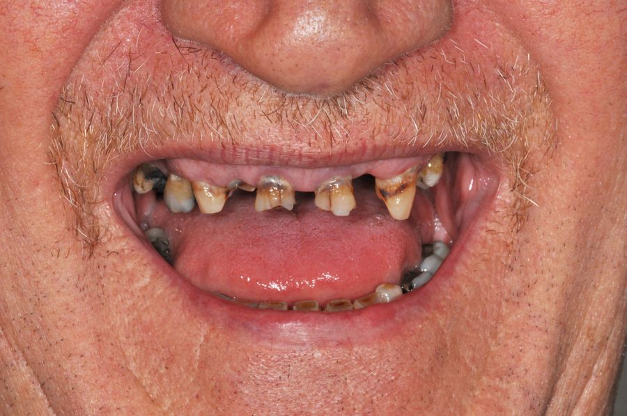 smile in a day - before